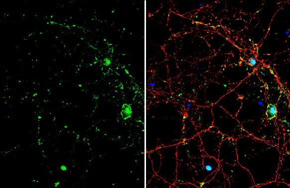 Immunocytochemistry/ Immunofluorescence - Anti-MADH7/SMAD7 antibody (AB272928)