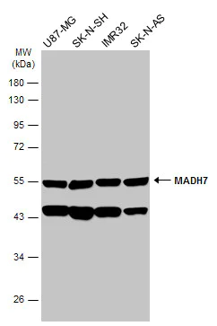 Western blot - Anti-MADH7/SMAD7 antibody (AB272928)