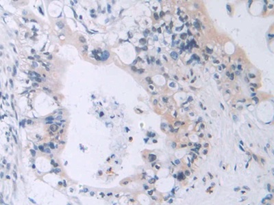 Immunohistochemistry (Formalin/PFA-fixed paraffin-embedded sections) - Anti-MAEA antibody (AB232987)