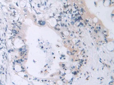 Immunohistochemistry (Formalin/PFA-fixed paraffin-embedded sections) - Anti-MAEA antibody (AB232987)