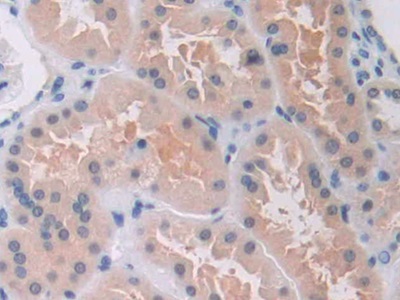 Immunohistochemistry (Formalin/PFA-fixed paraffin-embedded sections) - Anti-MAEA antibody (AB232987)