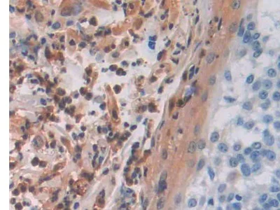 Immunohistochemistry (Formalin/PFA-fixed paraffin-embedded sections) - Anti-MAEA antibody (AB232987)