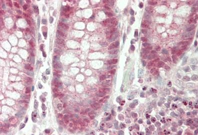 Immunohistochemistry (Formalin/PFA-fixed paraffin-embedded sections) - Anti-MAF1 antibody (AB230499)