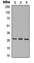Western blot - Anti-MAF1 antibody (AB230499)