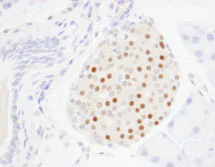 Immunohistochemistry (Formalin/PFA-fixed paraffin-embedded sections) - Anti-MAFA antibody (AB85008)