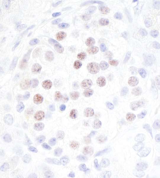Immunohistochemistry (Formalin/PFA-fixed paraffin-embedded sections) - Anti-MafA antibody [BLR067G] - BSA free (ab264418), expandable thumbnail