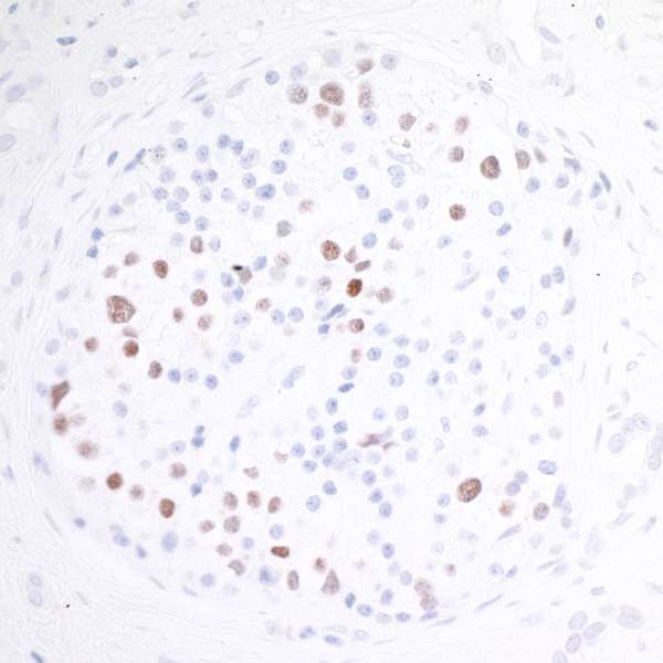 Immunohistochemistry (Formalin/PFA-fixed paraffin-embedded sections) - Anti-MafA antibody [BLR067G] - BSA free (AB264418), expandable thumbnail