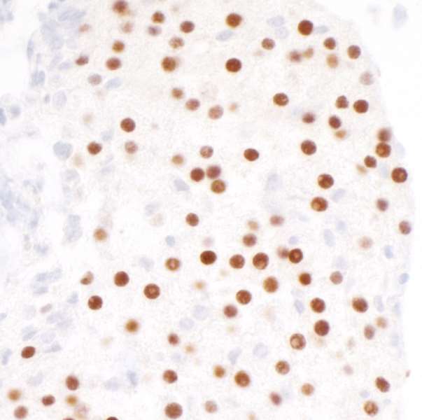 Immunohistochemistry (Formalin/PFA-fixed paraffin-embedded sections) - Anti-MafA antibody [BLR067G] - BSA free (AB264418), expandable thumbnail