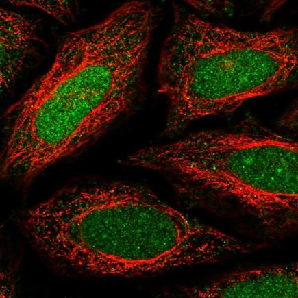 Immunocytochemistry/ Immunofluorescence - Anti-MafB antibody (AB223744), expandable thumbnail