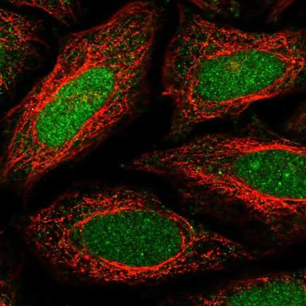 Immunocytochemistry/ Immunofluorescence - Anti-MafB antibody (AB223744)