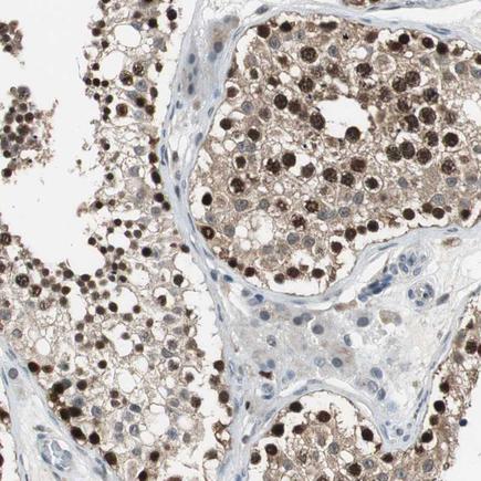 Immunohistochemistry (Formalin/PFA-fixed paraffin-embedded sections) - Anti-MafB antibody (AB223744), expandable thumbnail