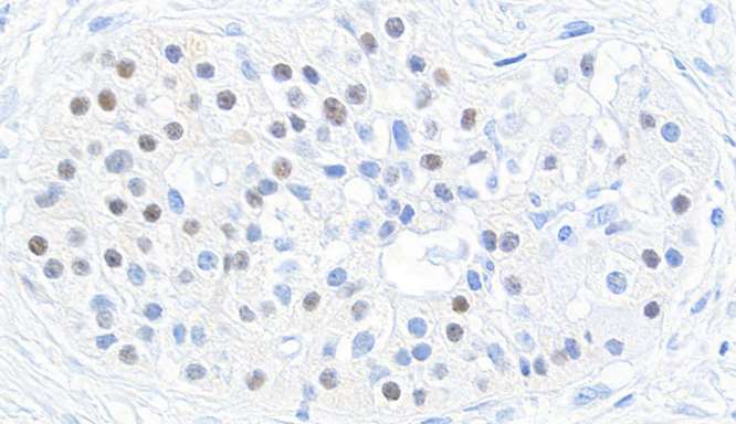 Immunohistochemistry (Formalin/PFA-fixed paraffin-embedded sections) - Anti-MafB antibody [BLR046F] - BSA free (AB243902), expandable thumbnail