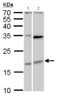 Western blot - Anti-MAFF antibody (AB183859), expandable thumbnail