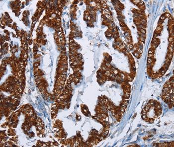 Immunohistochemistry (Formalin/PFA-fixed paraffin-embedded sections) - Anti-MAFF antibody (AB198249), expandable thumbnail