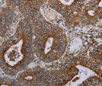 Immunohistochemistry (Formalin/PFA-fixed paraffin-embedded sections) - Anti-MAFF antibody (AB198249)