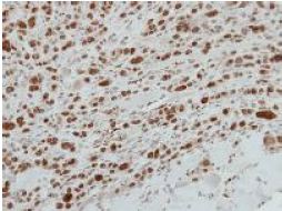 Immunohistochemistry (Formalin/PFA-fixed paraffin-embedded sections) - Anti-MAFG antibody (AB154318)