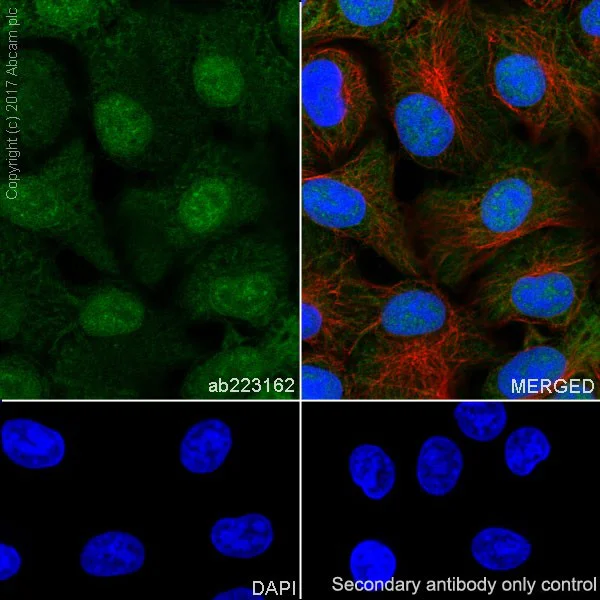 Immunocytochemistry/ Immunofluorescence - Anti-MAGE3 antibody [EPR19065] (AB223162)