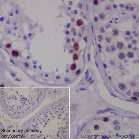Immunohistochemistry (Formalin/PFA-fixed paraffin-embedded sections) - Anti-MAGE3 antibody [EPR19065] (AB223162)