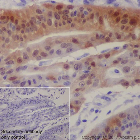 Immunohistochemistry (Formalin/PFA-fixed paraffin-embedded sections) - Anti-MAGE3 antibody [EPR19065] (AB223162)