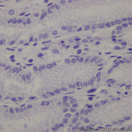 Immunohistochemistry (Formalin/PFA-fixed paraffin-embedded sections) - Anti-MAGE3 antibody [EPR19065] (AB223162)
