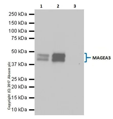 Immunoprecipitation - Anti-MAGE3 antibody [EPR19065] (AB223162)