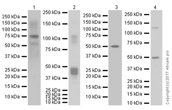 Western blot - Anti-MAGE3 antibody [EPR19065] (AB223162)