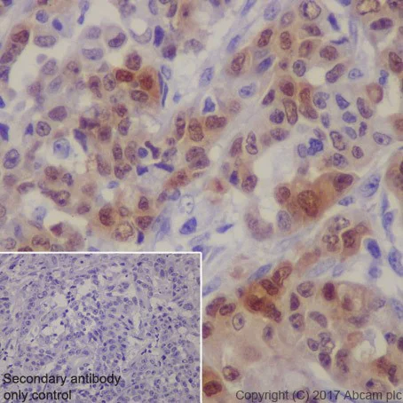 Immunohistochemistry (Formalin/PFA-fixed paraffin-embedded sections) - Anti-MAGE3 antibody [EPR19065] - BSA and Azide free (AB251574)