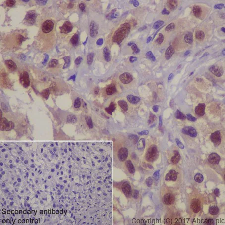 Immunohistochemistry (Formalin/PFA-fixed paraffin-embedded sections) - Anti-MAGE3 antibody [EPR19065] - BSA and Azide free (AB251574)
