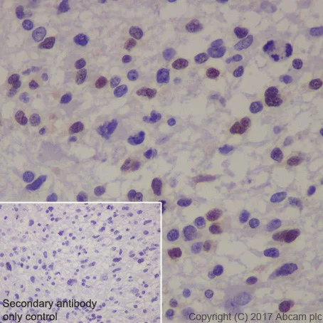 Immunohistochemistry (Formalin/PFA-fixed paraffin-embedded sections) - Anti-MAGE3 antibody [EPR19065] - BSA and Azide free (AB251574)