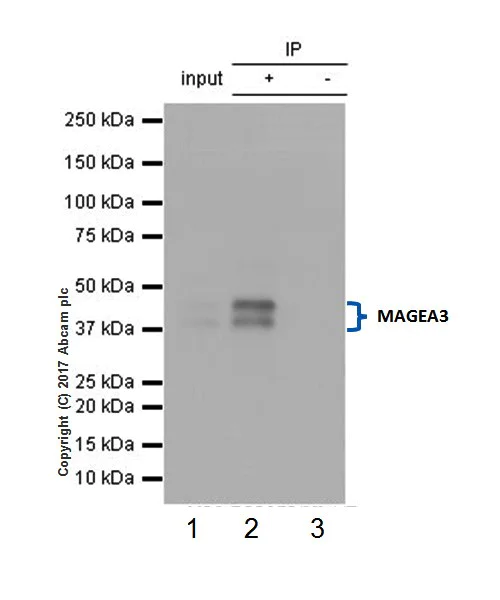 Immunoprecipitation - Anti-MAGE3 antibody [EPR20658] (AB213722)