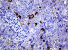 Immunohistochemistry (Formalin/PFA-fixed paraffin-embedded sections) - Anti-MAGE3 antibody [OTI1H1] (AB140678), expandable thumbnail