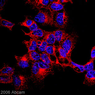 Immunocytochemistry/ Immunofluorescence - Anti-MAGEA1 antibody (AB16031)