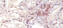 Immunohistochemistry (Formalin/PFA-fixed paraffin-embedded sections) - Anti-MAGEA1 antibody [MA454] (AB193330)