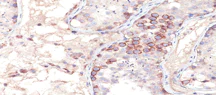 Immunohistochemistry (Formalin/PFA-fixed paraffin-embedded sections) - Anti-MAGEA1 antibody [MA454] (AB193330)