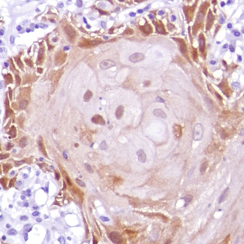 Immunohistochemistry (Formalin/PFA-fixed paraffin-embedded sections) - Anti-MAGEA1 antibody [SP188] (AB227664), expandable thumbnail