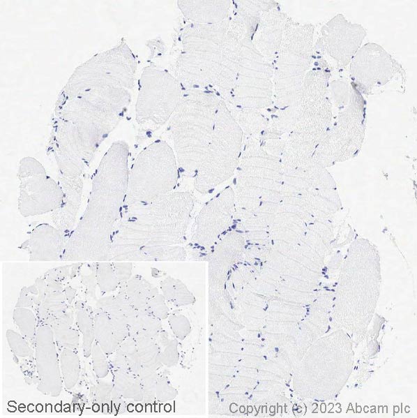 Immunohistochemistry (Formalin/PFA-fixed paraffin-embedded sections) - Anti-MAGEA1 antibody [SP188] (AB227664), expandable thumbnail