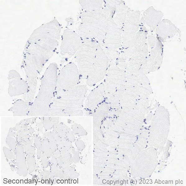 Immunohistochemistry (Formalin/PFA-fixed paraffin-embedded sections) - Anti-MAGEA1 antibody [SP188] (AB227664)