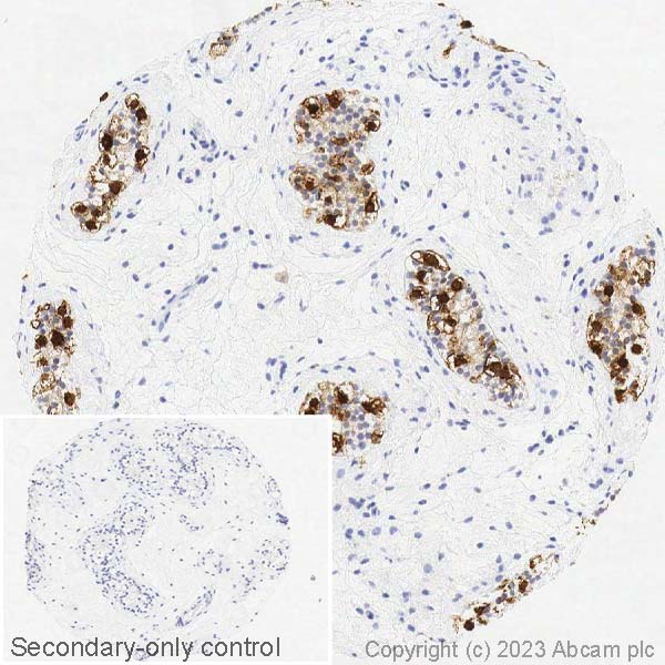 Immunohistochemistry (Formalin/PFA-fixed paraffin-embedded sections) - Anti-MAGEA1 antibody [SP188] (ab227664), expandable thumbnail