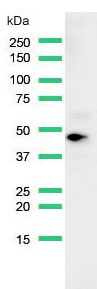 Western blot - Anti-MAGEA1 antibody [SP188] (AB227664), expandable thumbnail