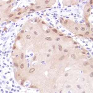 Immunohistochemistry (Formalin/PFA-fixed paraffin-embedded sections) - Anti-MAGEA1 antibody [SP194] - BSA and Azide free (AB245755)