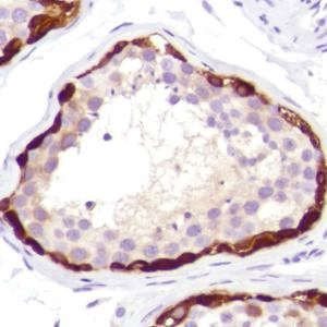 Immunohistochemistry (Formalin/PFA-fixed paraffin-embedded sections) - Anti-MAGEA1 antibody [SP194] - BSA and Azide free (AB245755)