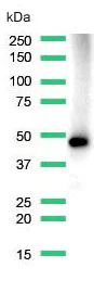 Western blot - Anti-MAGEA1 antibody [SP194] - C-terminal (AB183309)
