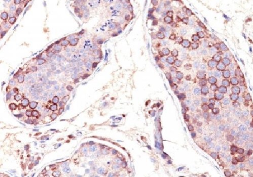 Immunohistochemistry (Formalin/PFA-fixed paraffin-embedded sections) - Anti-MAGEA1 antibody [SPM282] (AB25834)