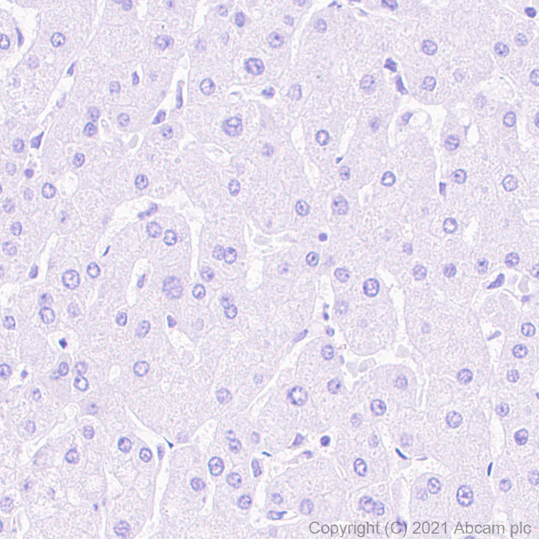 Immunohistochemistry (Formalin/PFA-fixed paraffin-embedded sections) - Anti-MAGEA10 antibody [EPR24366-89] (AB271057)