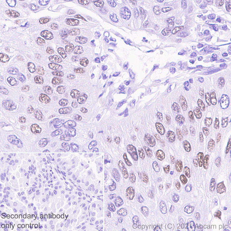Immunohistochemistry (Formalin/PFA-fixed paraffin-embedded sections) - Anti-MAGEA10 antibody [EPR24366-89] (AB271057)