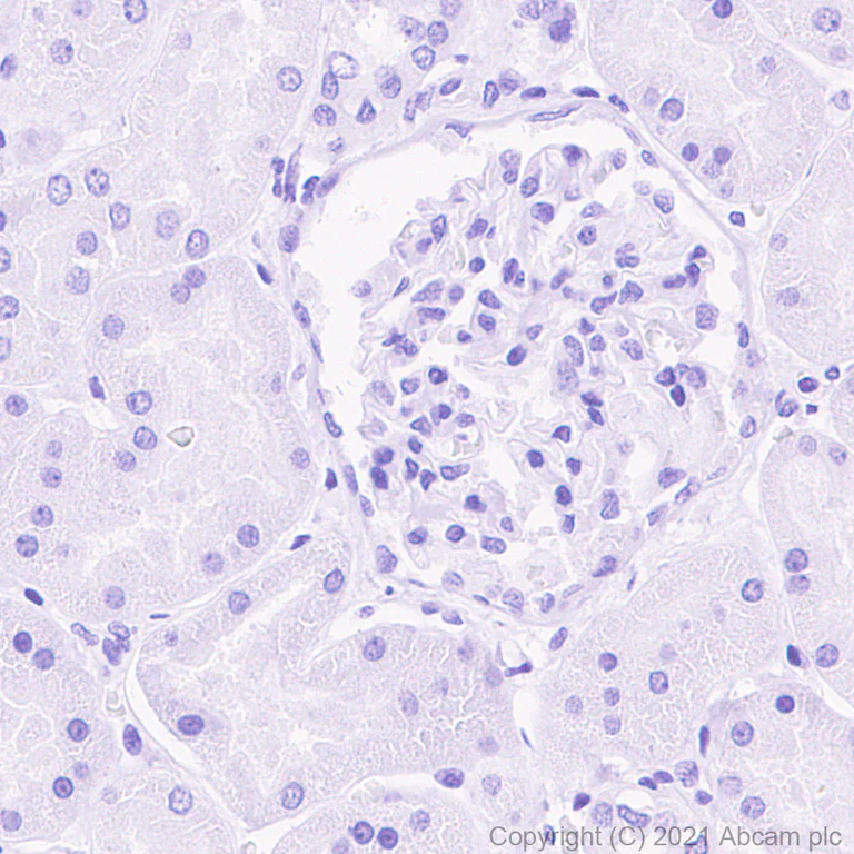 Immunohistochemistry (Formalin/PFA-fixed paraffin-embedded sections) - Anti-MAGEA10 antibody [EPR24366-89] (AB271057)