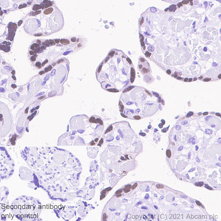 Immunohistochemistry (Formalin/PFA-fixed paraffin-embedded sections) - Anti-MAGEA10 antibody [EPR24366-89] - BSA and Azide free (AB282590)