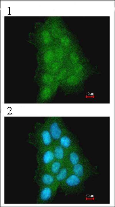 Immunocytochemistry/ Immunofluorescence - Anti-MAGEA11 antibody (AB96236)
