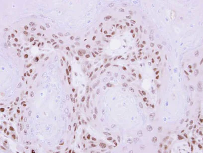 Immunohistochemistry (Formalin/PFA-fixed paraffin-embedded sections) - Anti-MAGEA11 antibody (AB96236)