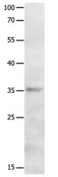 Western blot - Anti-MAGEA2 antibody (AB198264)